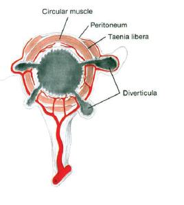 formazione dei diverticoli